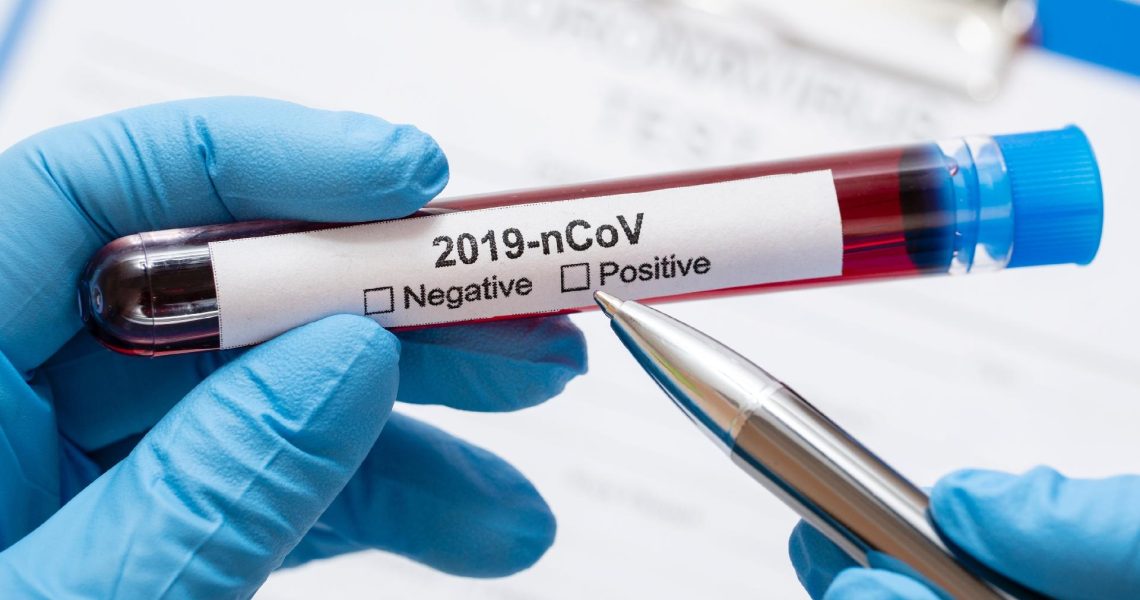 teste-novo-coronavirus 1